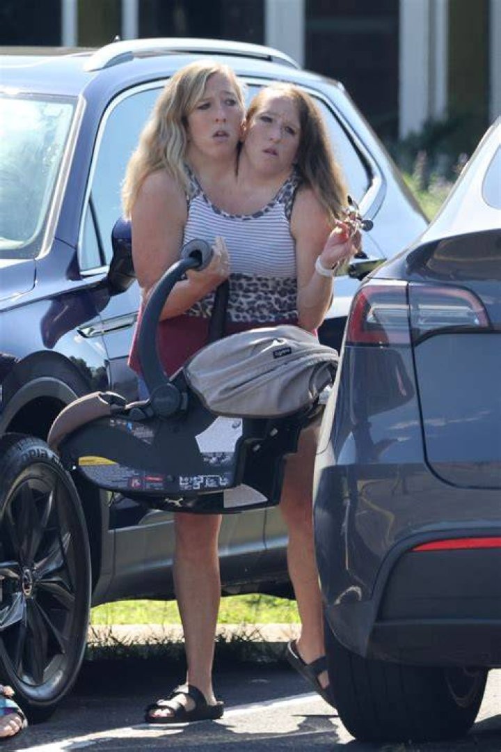 Abby and brittany hensel conjoined twins engaged pnafile