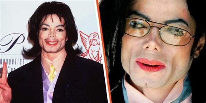 Did Michael Jackson have low self esteem? (Skin Color and Nose Change