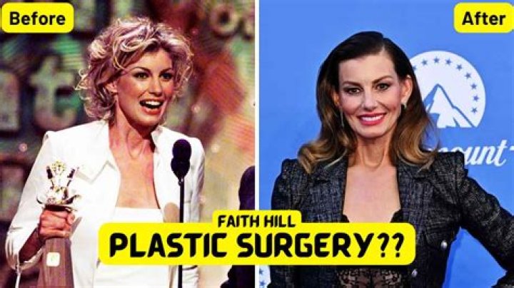 Faith Hill Plastic Surgery A Youthful Look For A Country Star