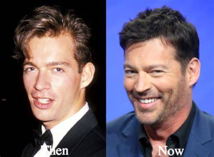 Harry Connick Jr. Recovers After Mild Stroke