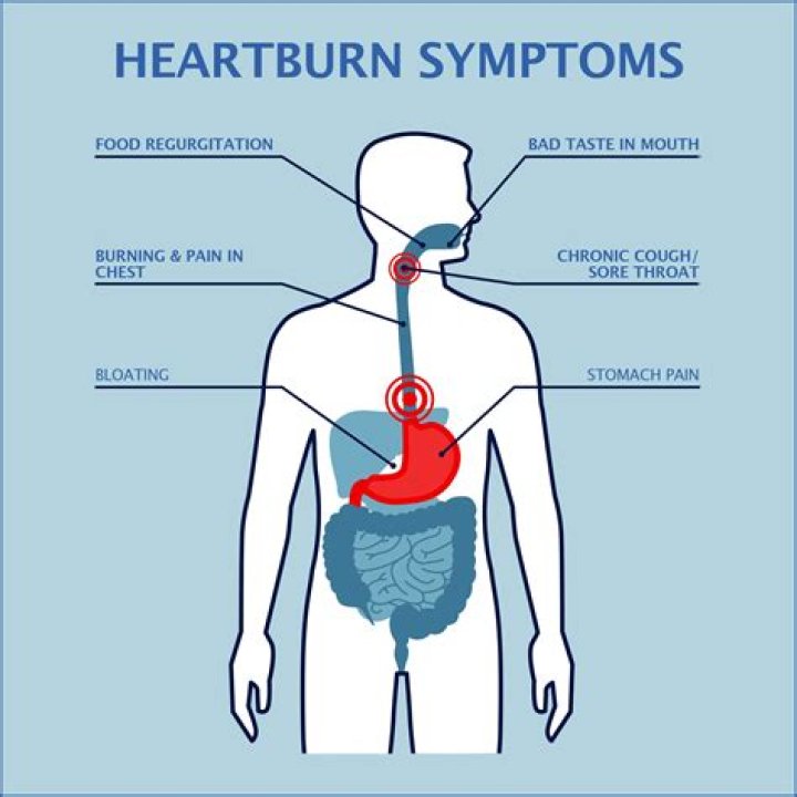 Heartburn Causes