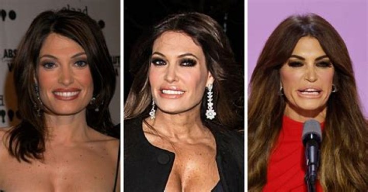 Kimberly Guilfoyle before and after plastic surgery 03 Celebrity
