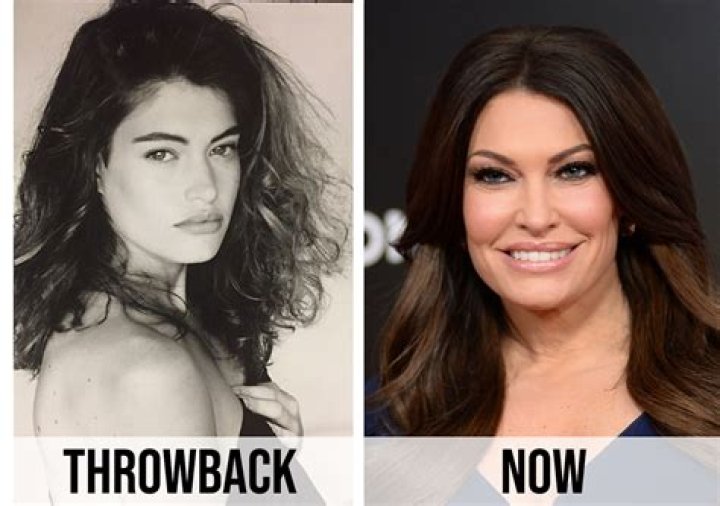 Kimberly Guilfoyle Plastic Surgery Kimberly Guilfoyle Face Before And