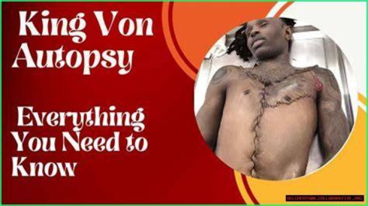 King Von Autopsy Photo Twitter BAHIA HAHA