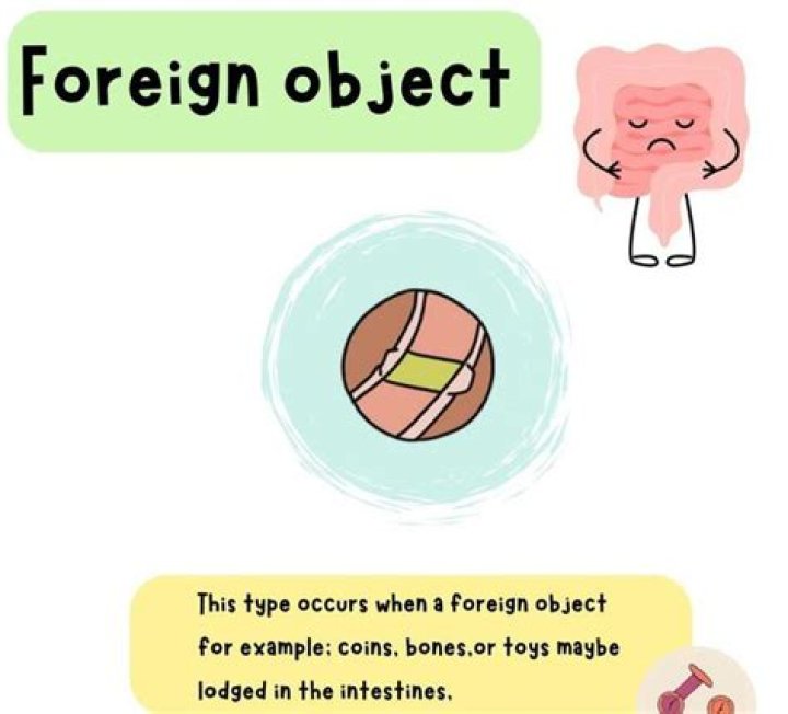 My 123 Cents Foreign Object Friday Rick Martel's Arrogance