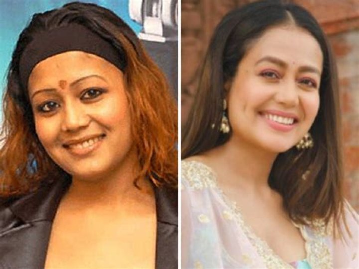 Neha Kakkar transformation These beforeandafter photos of Neha