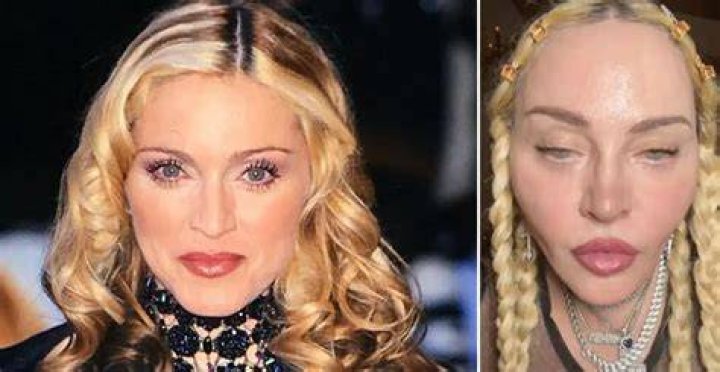 PHOTO What happened to Madonna's face? To