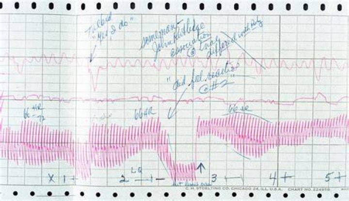 The Results are In Polygraph Reveals Truth behind the Hank Baskett