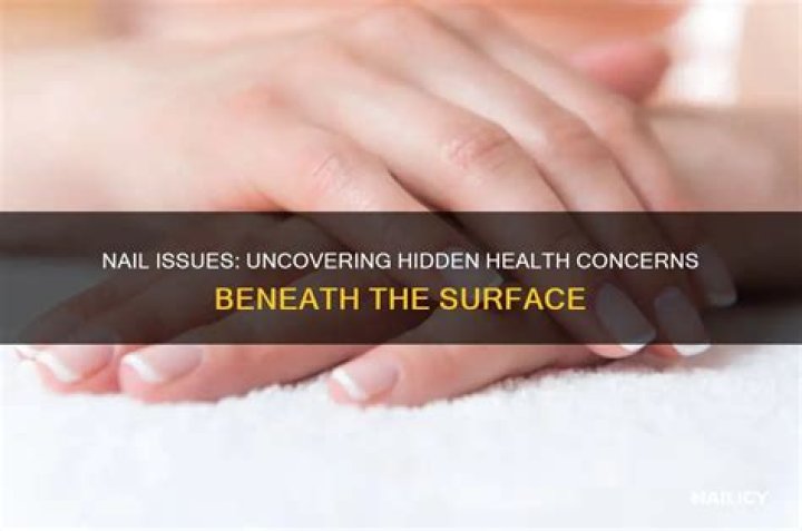 Uncovering The Health Concerns Of Dana Perino's Husband