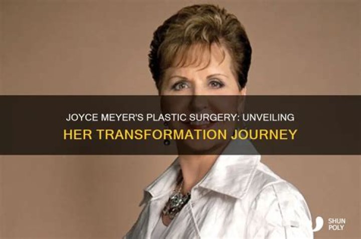 Unveiling Joyce Meyer's True Face: Before The Knife
